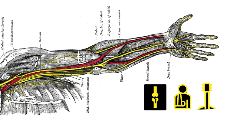 John E Walker- Nerve Injury Recovery Guitar Focal Dystonia Classical Guitar magazine